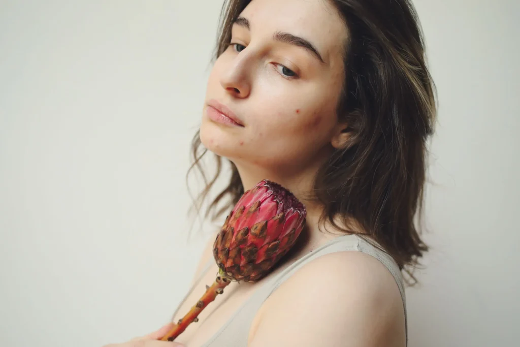 Woman with acne-prone skin following a gentle skincare routine