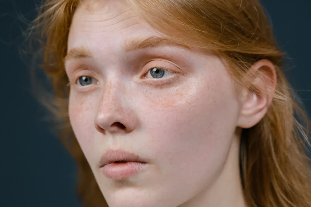 Woman moisturizing dry skin to improve hydration and skin barrier